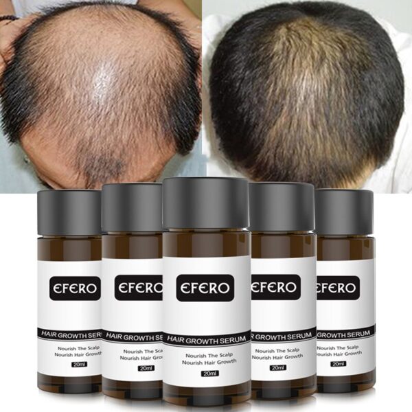 3pcs Anti Hair Loss Treatment Hair Growth Essence Serum Scalp Nourishing Prevent Baldness Thicker Nourish Hair Care 20ml