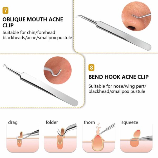 Stainless Steel Facial Acne Blackhead Remover Needles Extractor Pimple Blemish Comedone Removal Kit Double Head Face Care Tool