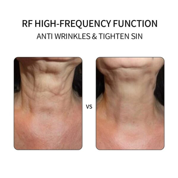 5in1 RF EMS Electroporation LED Photon Light Therapy Beauty Device Anti Aging Face Lifting Tightening Eye Facial Skin Care Tools