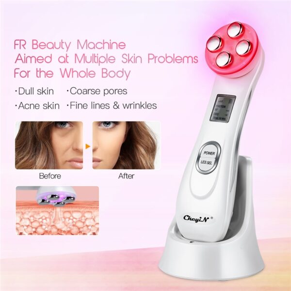 EMS Mesotherapy RF Radio Frequency Facial Beauty Massager Mini Face Sprayer Ultrasoic Skin Scrubber Electric Blackhead Remover