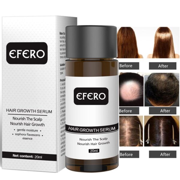 3pcs Anti Hair Loss Treatment Hair Growth Essence Serum Scalp Nourishing Prevent Baldness Thicker Nourish Hair Care 20ml